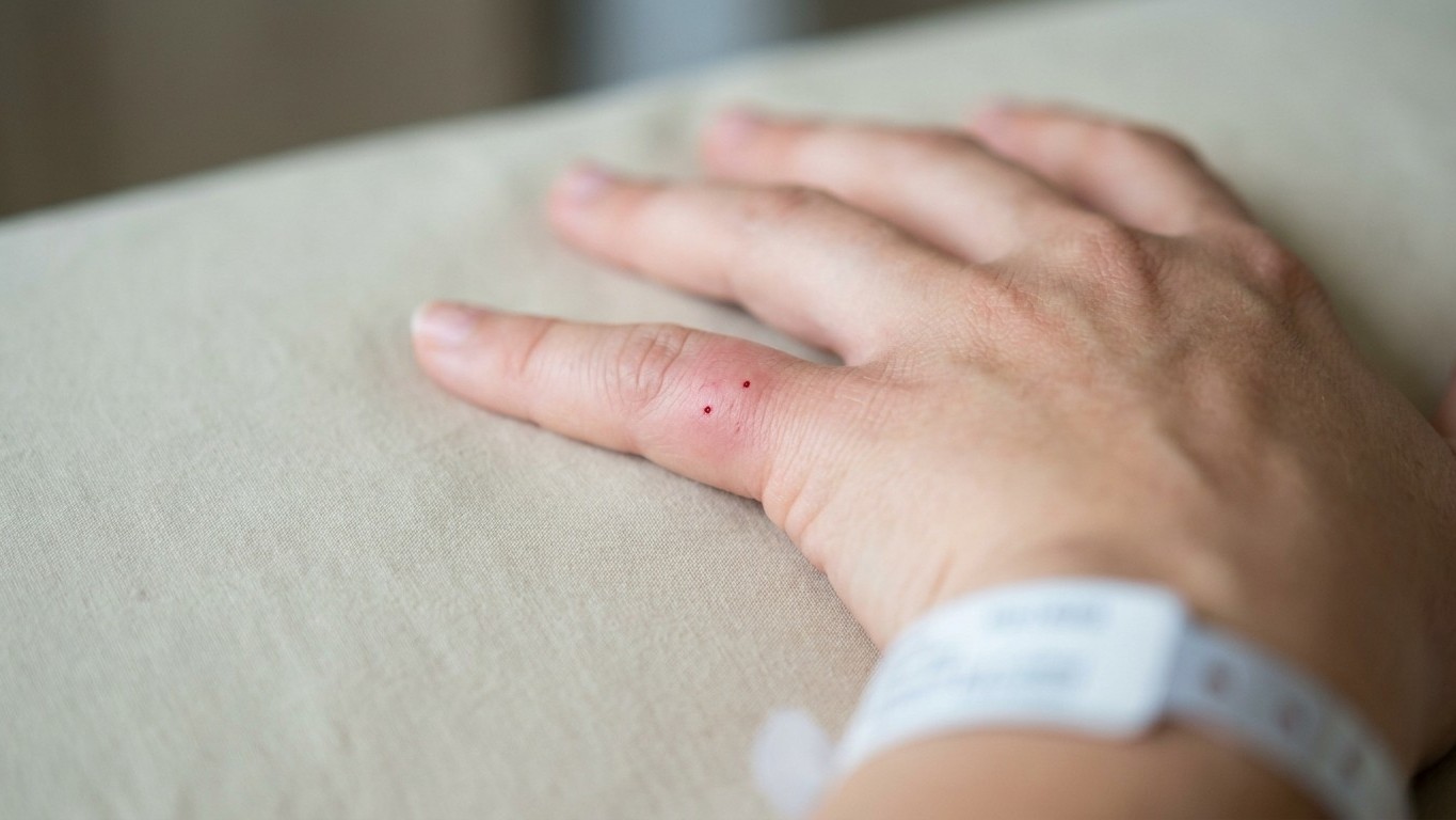 My cat bit my hand and the two little holes closed up within the hour: twelve hours later, at the emergency room, I unders...